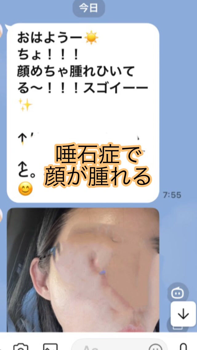 画像2193